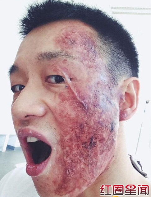 佟大为烧伤变老爷爷原因真相佟大为女儿叫什么名字素颜照片