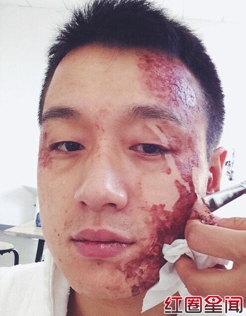 佟大为烧伤变老爷爷原因真相佟大为女儿叫什么名字素颜照片