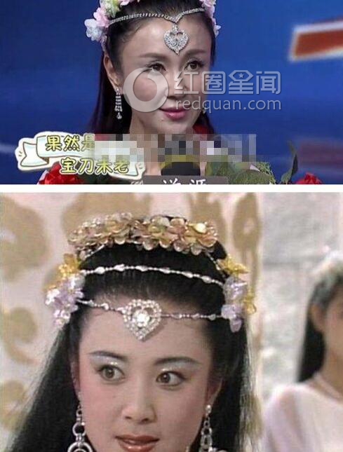 明星整容失败前后照片