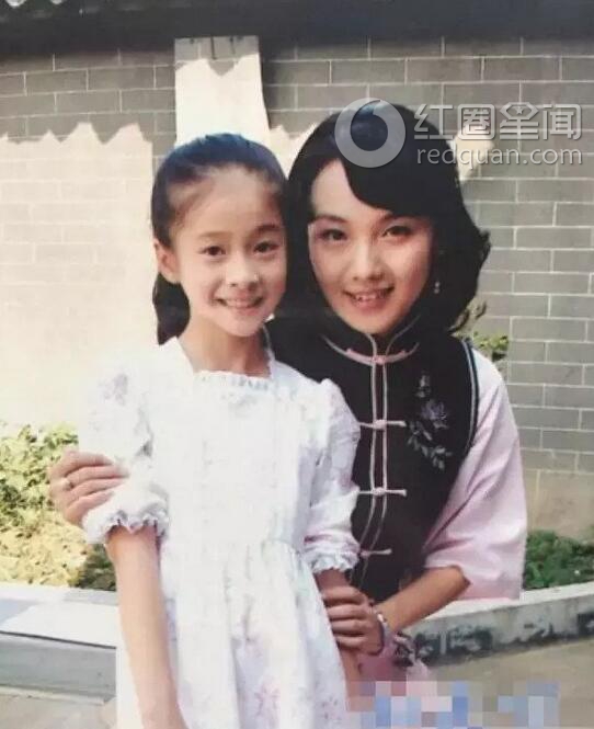 张雪迎整容前后图片