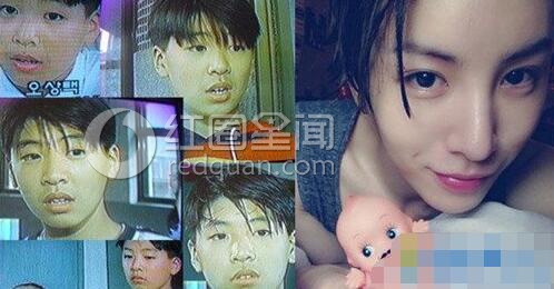 鲁敏宇整容前后对比