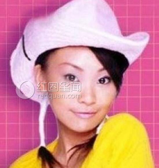 丁小芹整容几次