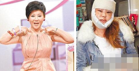 女星整容前后照片对比
