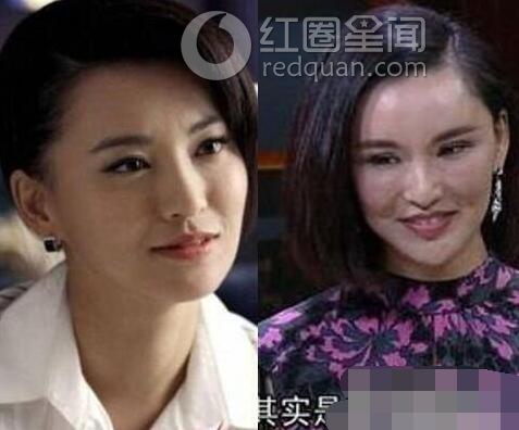 女星整容前后照片对比