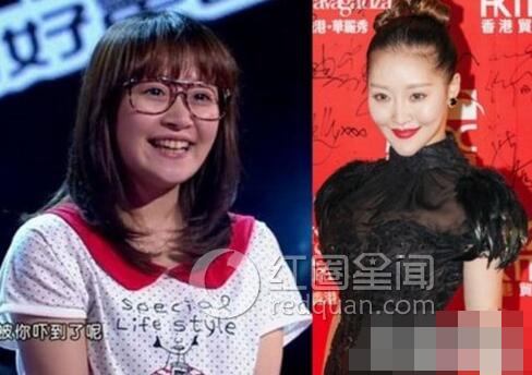 女星整容前后照片对比