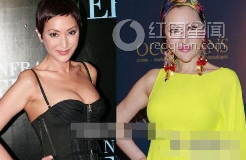 女星整容前后照片对比