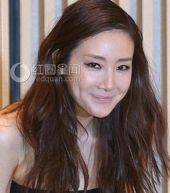 崔智友整容前后对比