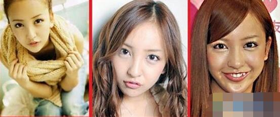 板野友美整容了吗