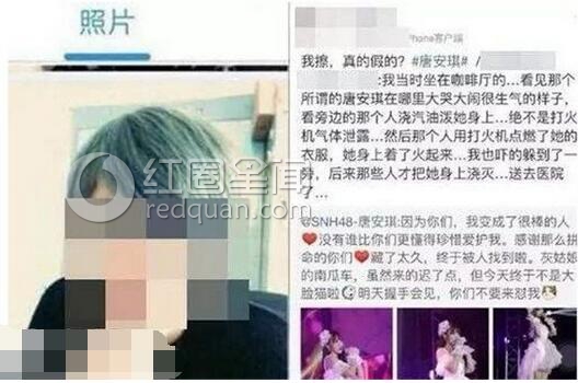 唐安琪烧伤真相