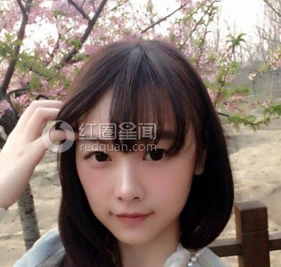 唐安琪烧伤真相