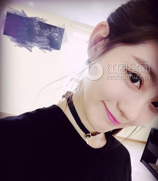 祝绪丹整容了吗