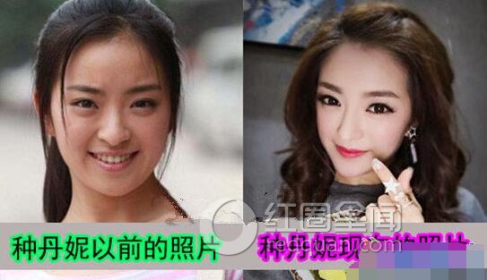种丹妮整容了吗