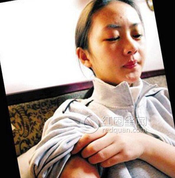 童瑶张默事件是怎么回事