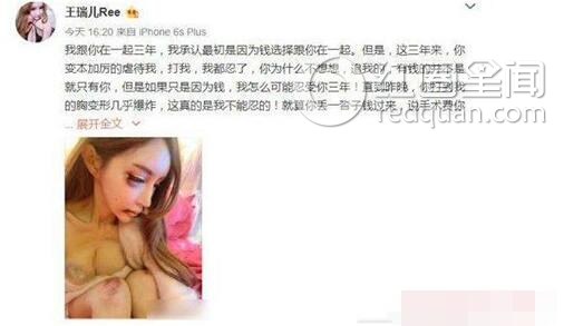王瑞儿被打原因