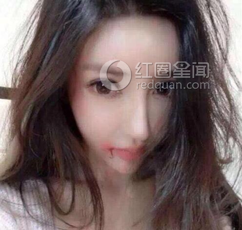王瑞儿被打原因