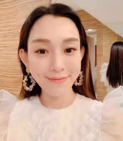 范玮琪下巴缝15针