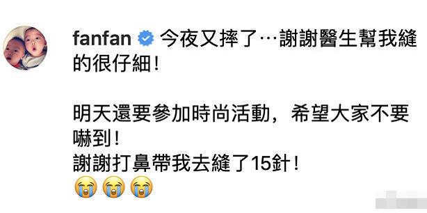 范玮琪下巴缝15针